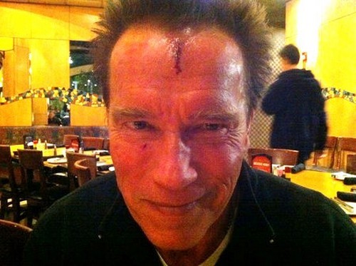 The Last Stand, Arnold Schwarzenegger si ferisce sul set